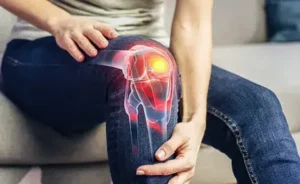 Knee Arthritis