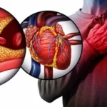 Primary Care Strategies for Heart Disease Prevention
