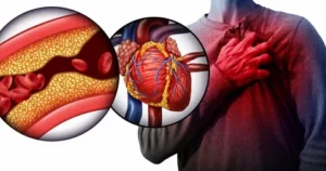 Primary Care Strategies for Heart Disease Prevention