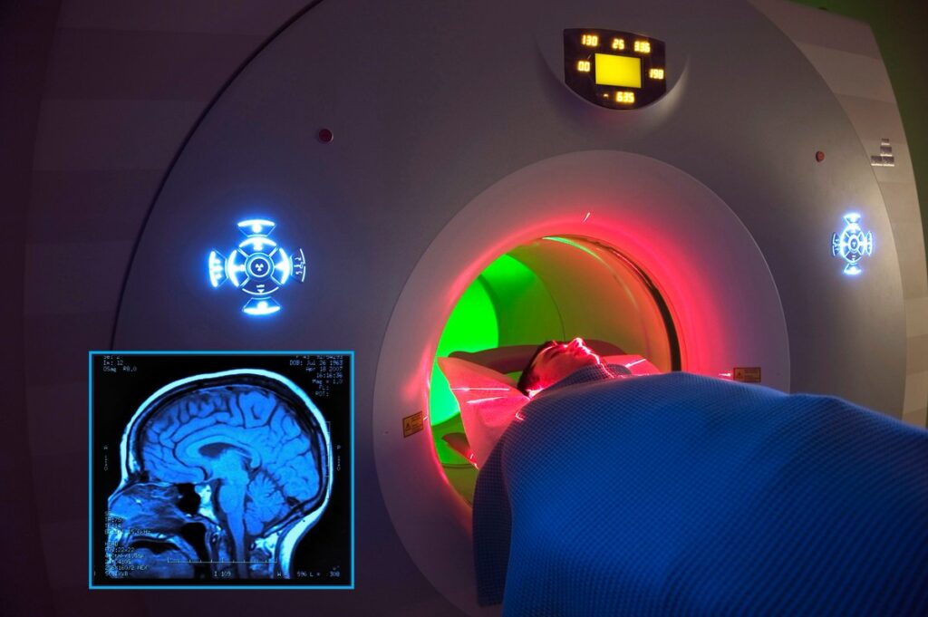 Brain MRI Scan Advances in Detecting Alzheimer’s and Dementia: How Imaging Technology is Changing Early Diagnosis