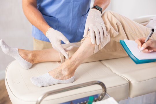 Swelling, Pain, and Fatigue: When It’s Time to Consider Vein Treatment