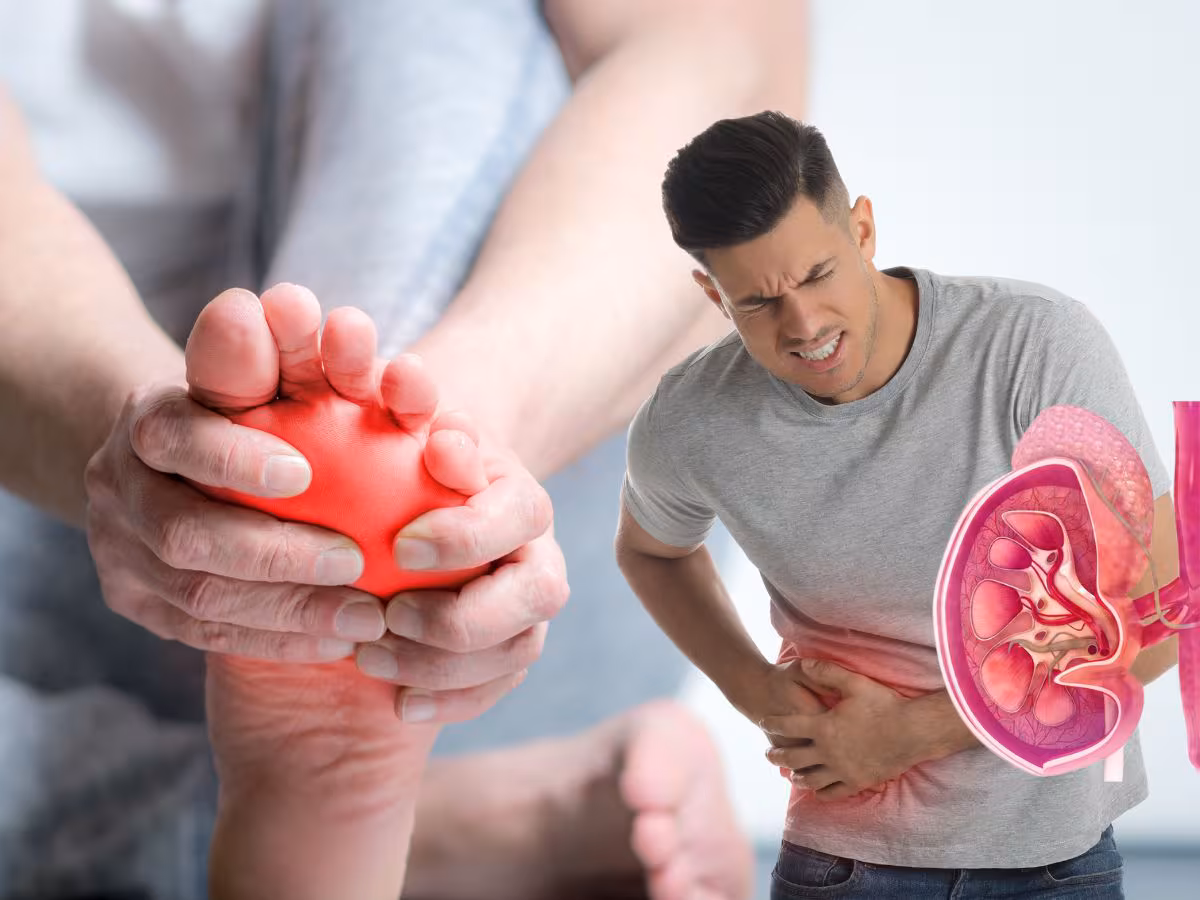 When Passing a Kidney Stone: What to Expect—and When to See a Doctor