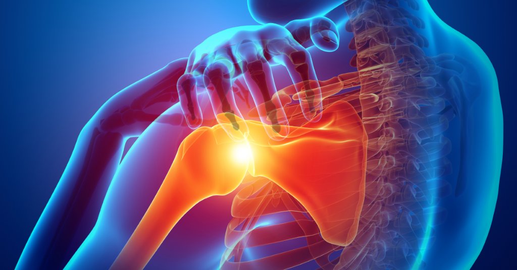 Surgical vs. Non-Surgical Treatments for Shoulder Arthritis