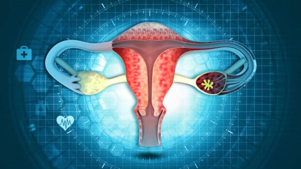 How Doctors Diagnose Uterine Fibroids: Tests and Imaging Explained