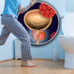 Overactive Bladder in Men: Causes, Diagnosis, and Modern Treatment Options