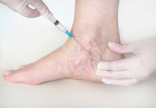 Big Apple Medical Care’s Advanced Approach to Vascular Surgery